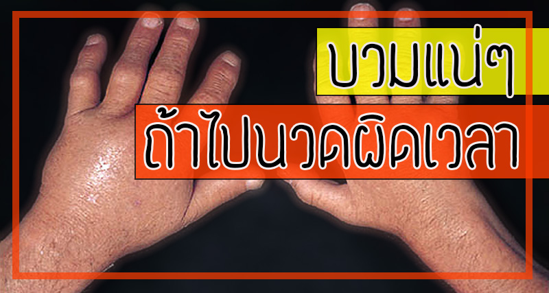 กล้ามเนื้ออักเสบ, บวม, ประคบเย็น, นวด, ยิ่งนวดยิ่งบวม, ยานวด, ข้ออักเสบ กล้ามเนื้ออักเสบ, บวม, ประคบเย็น, นวด, ยิ่งนวดยิ่งบวม, ยานวด, ข้ออักเสบ